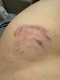 LockedUpMaso leak - Impact play session with The Cane #masochist #p