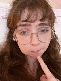 clarabelles leak - I hab acne