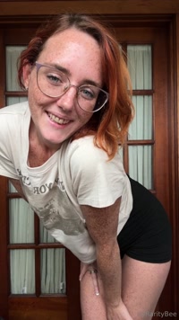 raritybee leak - Update: everything went great at the dentist!! I’m totally f..