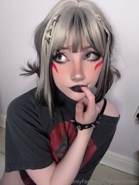 rynkerbellee leak - Hii everyone!! surgery went well and back to making content ..